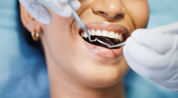 Best Pediatric Emergency Dentist in De Kal, TX